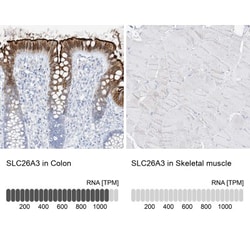 SLC26A3 Antibody, Novus Biologicals 25 &mu;L; Unlabeled:Antibodies, Polyclonal